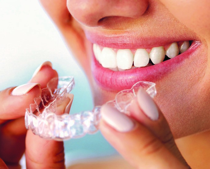 Take control of your smile with dental braces